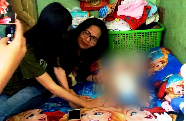 Pemkot Surabaya Telah Berikan Bantuan ke Keluarga Bayi Hydrocephalus Sejak Juni 2019