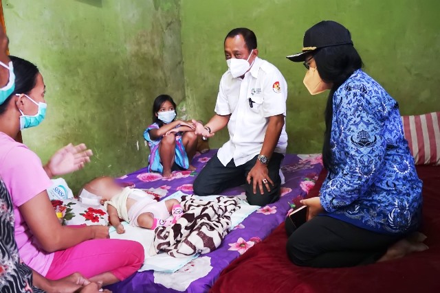 Pemkot Surabaya Respon Cepat Tangani Bayi Elora Penderita Hidrosefalus