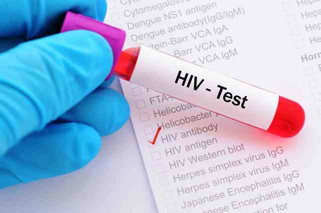 Pemkot Surabaya Beri Kemudahan Akses Testing HIV Gratis