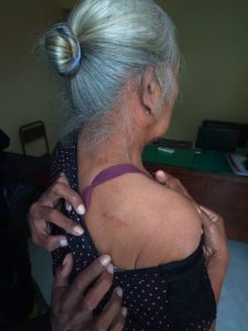 Nenek di Kediri Jadi Korban Curas di Jalanan, Sasaran Kalung Emas