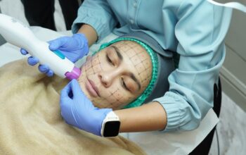 Rahasia Wajah Kencang Tanpa Bedah: Luna Maya Pilih Ulthermage