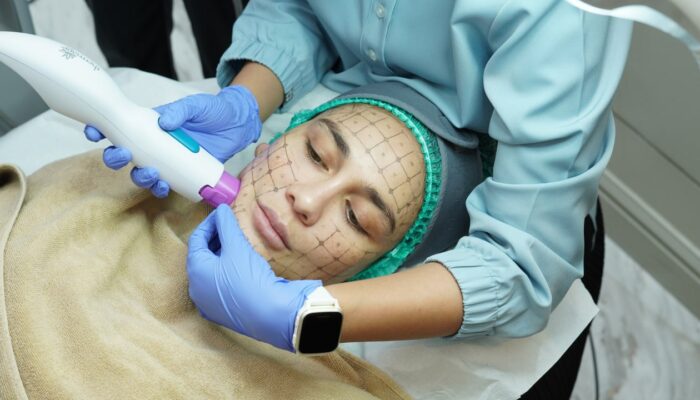 Rahasia Wajah Kencang Tanpa Bedah: Luna Maya Pilih Ulthermage
